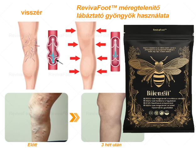 VascuTone™  🍃Bee venom lymphatic detoxification slimming foot bath beads -- (Doctor recommended - suitable for all lymphatic problems and obesity)