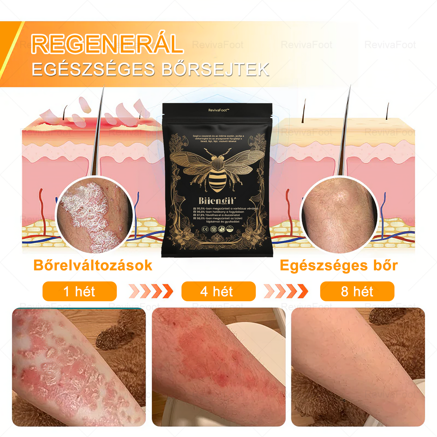 VascuTone™  🍃Bee venom lymphatic detoxification slimming foot bath beads -- (Doctor recommended - suitable for all lymphatic problems and obesity)