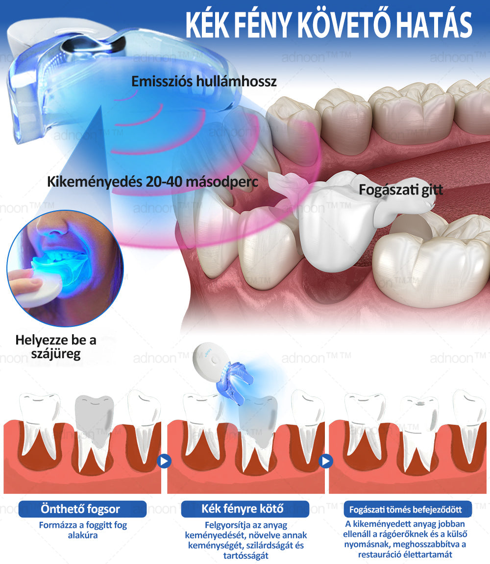 Hivatalos bolt | ABNOON™ Kék Fényes Gyógyító Lámpa és Fogpótló Anyagok  🧑🏼‍⚕️FDA Által Jóváhagyva (Hiányzó fogak, eltört fogak és rések javítására)