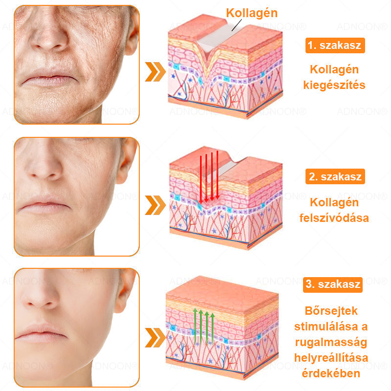 ADNOON® 🌼 Napi krém a gyors bőrregenerációért - a Magyar Bőrgyógyász Társaság (MBD) ajánlása szerint ⚕️👨