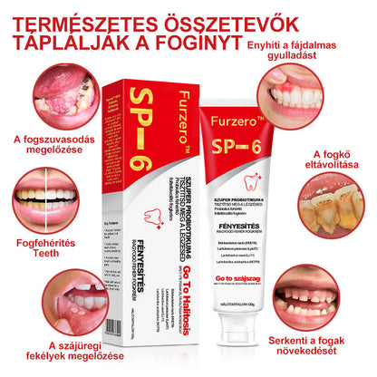 SZEZYY™ SP-6 Probiotic Ultra Whitening Toothpaste🪥🦷👨‍⚕️Recommendation🔥75% OFF🔥 (Copy)