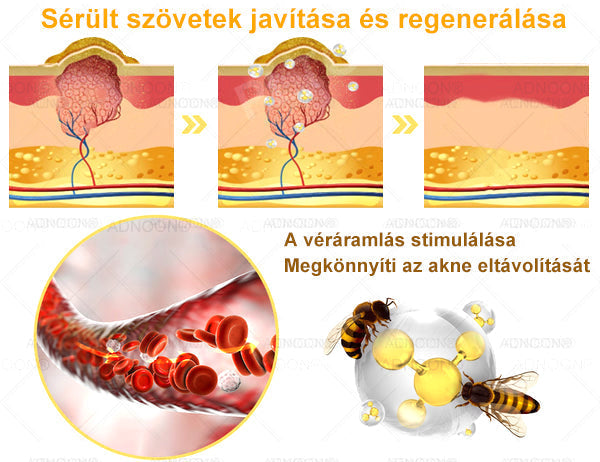 ADNOON® 🌼 Napi krém a gyors bőrregenerációért - a Magyar Bőrgyógyász Társaság (MBD) ajánlása szerint ⚕️👨